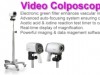 New Video Colposcope