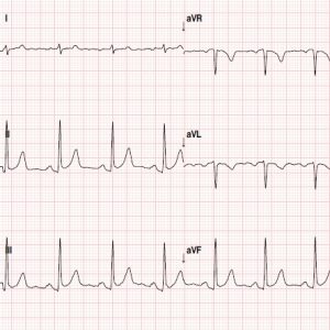 Cardiology